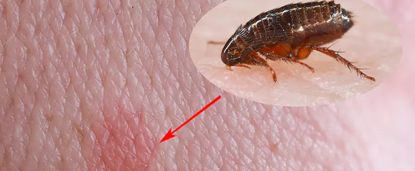 Flea Control for Humans Marietta, GA